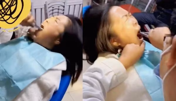 Bac si nha khoa khien ai cung het hon khi nho rang khon