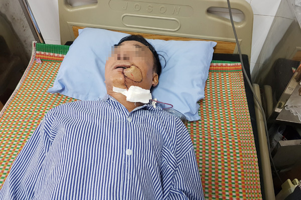 Những người dễ bị ung thư miệng ghé thăm Nhung nguoi de bi ung thu mieng ghe tham