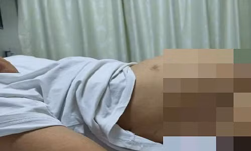 Bung to nhu co thai 7 thang, nao ngo nu sinh mac benh u quai buong trung