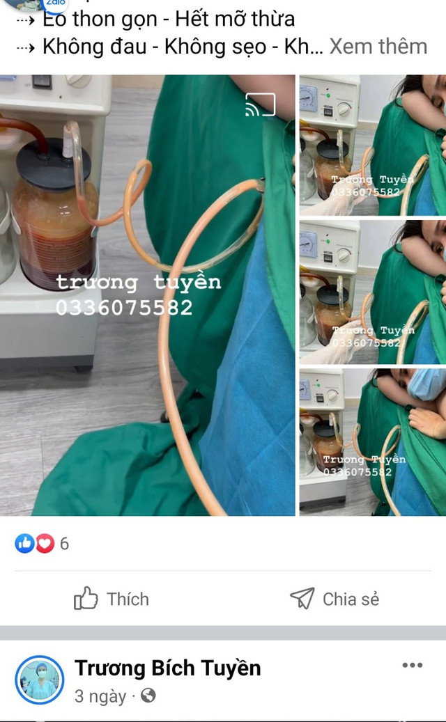 TMV Hoa Sen quảng cáo lố: Thực hiện quy trình hút mỡ như “lò mổ“? - Hình 2 TMV Hoa Sen quang cao lo: Thuc hien quy trinh hut mo nhu “lo mo“?-Hinh-2