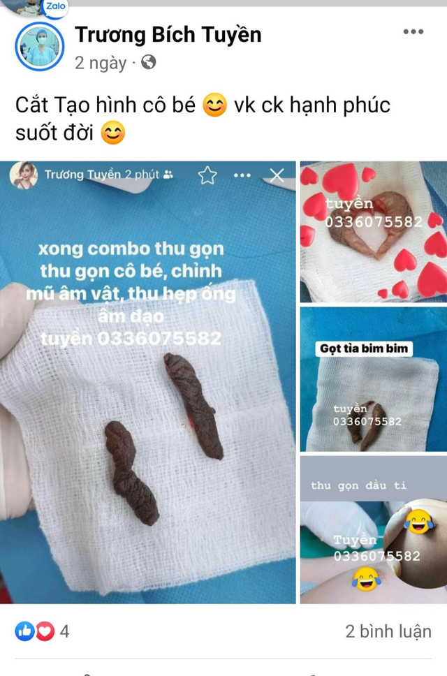 TMV Hoa Sen quảng cáo lố: Thực hiện quy trình hút mỡ như “lò mổ“? - Hình 4 TMV Hoa Sen quang cao lo: Thuc hien quy trinh hut mo nhu “lo mo“?-Hinh-4