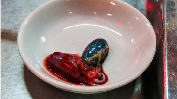 Những món ăn kinh dị từ thời xưa giúp tăng cường bản lĩnh đàn ông - Hình 2 Nhung mon an kinh di tu thoi xua giup tang cuong ban linh dan ong-Hinh-2