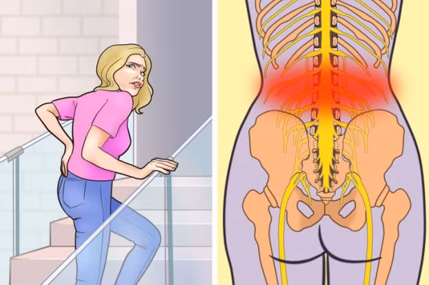 7 thoi quen gay dau lung ma ban can sua ngay lap tuc-Hinh-6