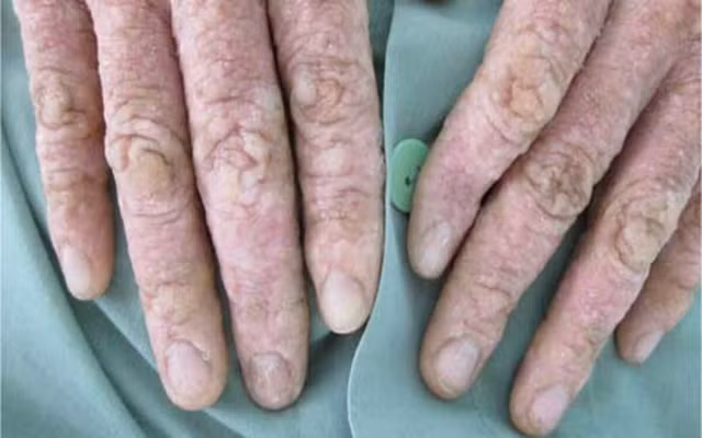 11 nguyen nhan bat ngo co the gay benh gan cho ban-Hinh-11