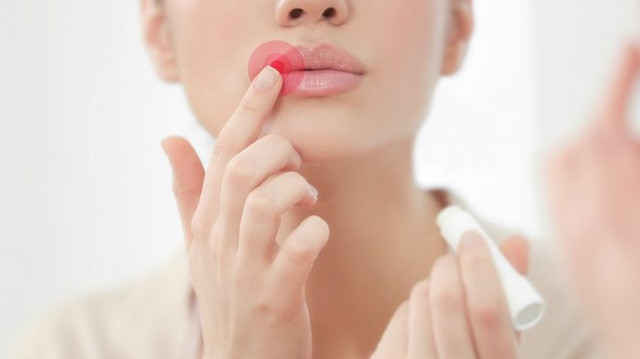 Hoảng hốt nhìn đôi môi biến chứng sau 17 lần làm đẹp - Hình 5 Hoang hot nhin doi moi bien chung sau 17 lan lam dep-Hinh-5