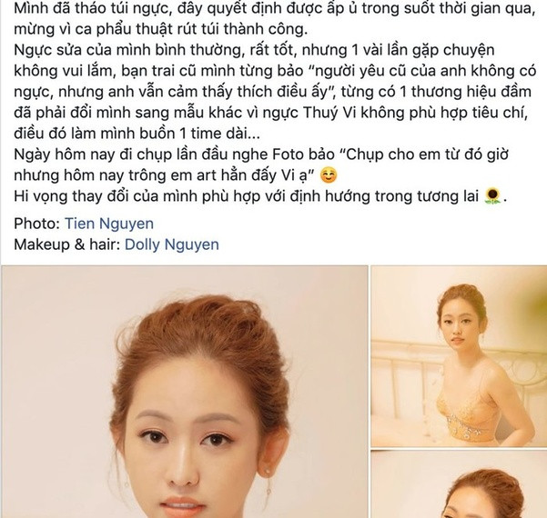 Hàng loạt sao Việt tháo túi ngực: Tiết lộ lý do khủng khiếp Hang loat sao Viet thao tui nguc: Tiet lo ly do khung khiep