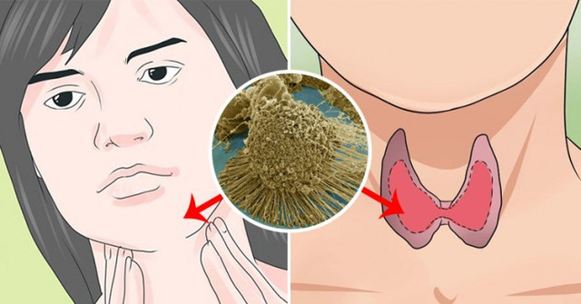 Tăng cân bất thường có phải là bệnh? - Hình 3 Tang can bat thuong co phai la benh?-Hinh-3