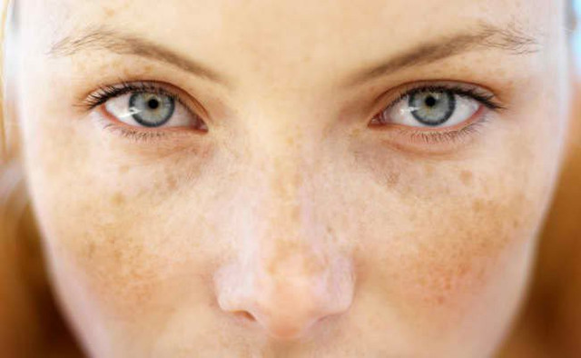 Lợi ích sức khỏe gây bất ngờ của cây kim ngân hoa - Hình 8 Loi ich suc khoe gay bat ngo cua cay kim ngan hoa-Hinh-8