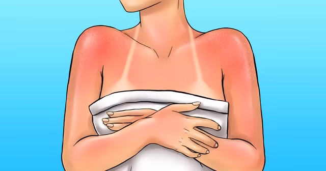 8 cach ngan chan lan da khong bi lao hoa nhanh-Hinh-3