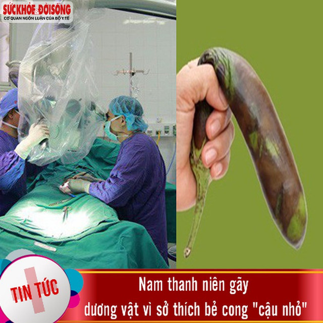 Những trường hợp nam giới “gãy súng” khó tin - Hình 2 Nhung truong hop nam gioi “gay sung” kho tin-Hinh-2