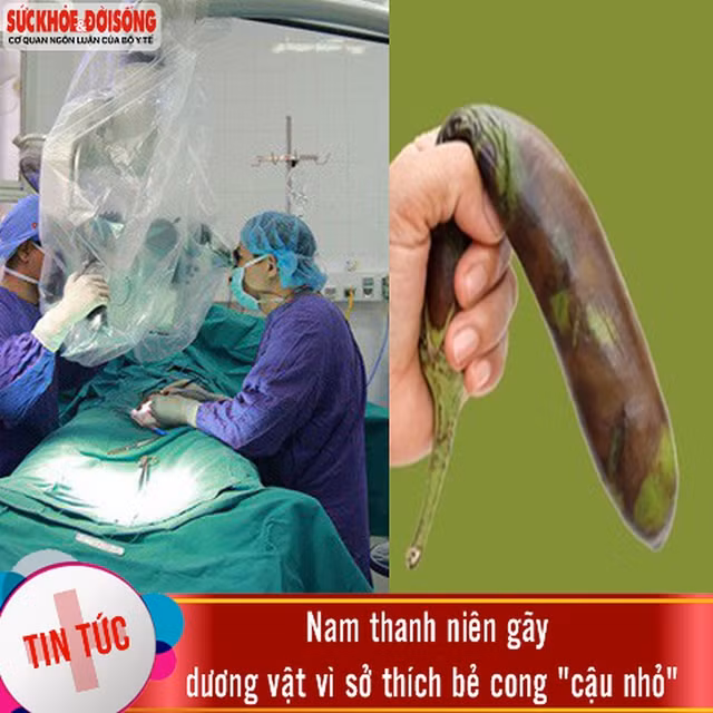 Nhung truong hop nam gioi “gay sung” kho tin-Hinh-2