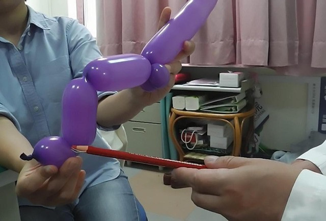 Những trường hợp nam giới “gãy súng” khó tin - Hình 4 Nhung truong hop nam gioi “gay sung” kho tin-Hinh-4