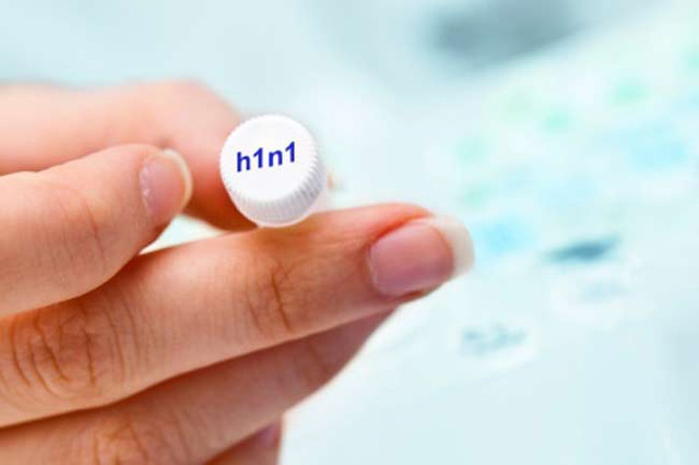 Nhận diện các loại bệnh cúm để điều trị hiệu quả - Hình 2 Nhan dien cac loai benh cum de dieu tri hieu qua-Hinh-2