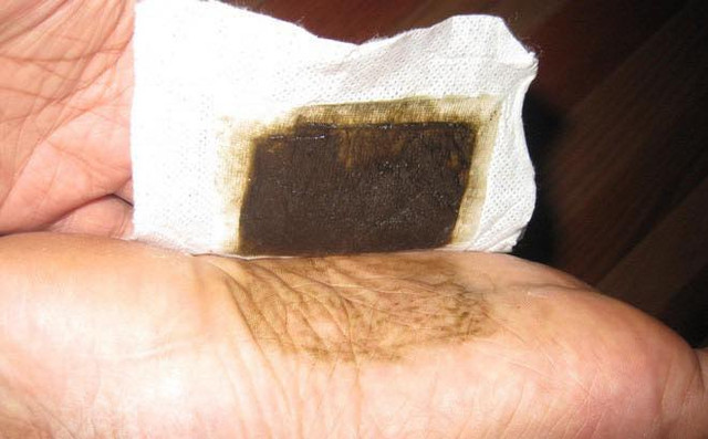 Miếng dán thải độc lòng bàn chân có thực sự thần kỳ? Mieng dan thai doc long ban chan co thuc su than ky?