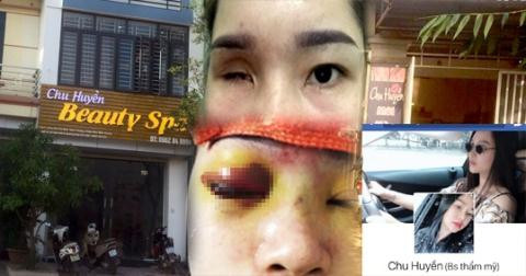 Spa Chu Huyền nói gì khi làm mù mắt cô gái tiêm filler nâng mũi? Spa Chu Huyen noi gi khi lam mu mat co gai tiem filler nang mui?