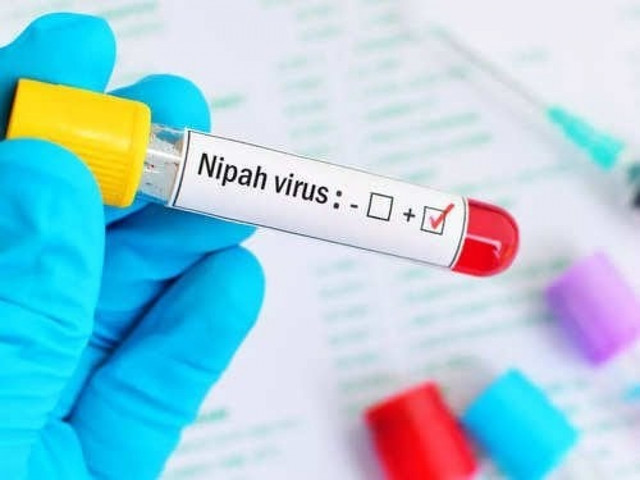 Virus Nipah bùng phát, tỷ lệ tử vong tới 75% Virus Nipah bung phat, ty le tu vong toi 75%