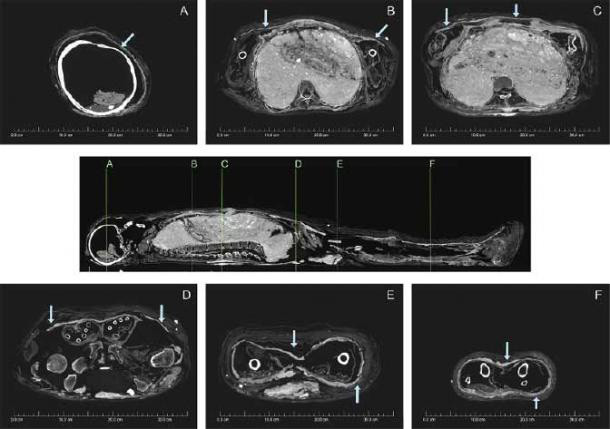 Bí ẩn một xác ướp được làm 2 lần - Hình 5 Bi an mot xac uop duoc lam 2 lan-Hinh-5