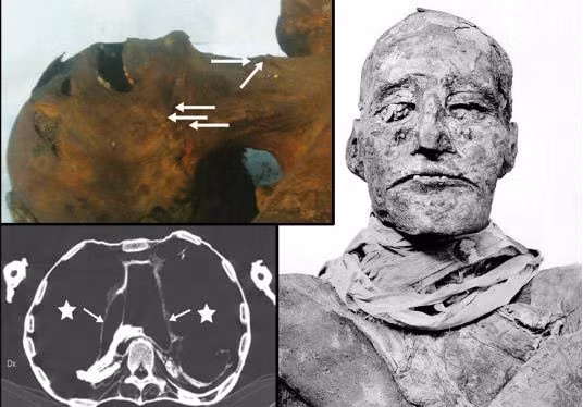 Bi mat duoc he lo khi chup cat lop xac uop pharaoh Ai Cap-Hinh-4