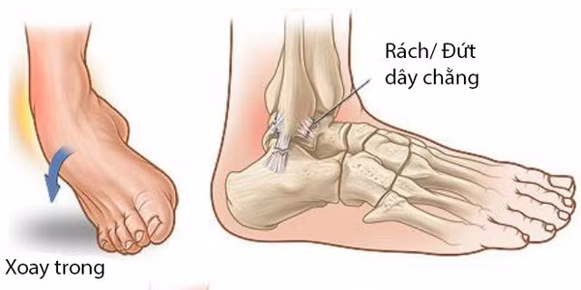 Dieu tri treo mat ca, ran xuong chan cho ong Biden the nao?-Hinh-2