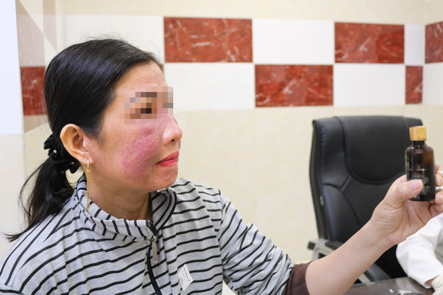 Hiểm hoạ khó lường từ lạm dụng mỹ phẩm trắng da cấp tốc Hiem hoa kho luong tu lam dung my pham trang da cap toc