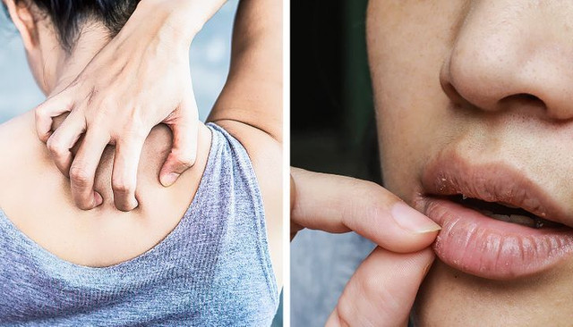 7 điều kỳ diệu cho sức khoẻ khi uống một thìa dầu ô liu mỗi sáng - Hình 6 7 dieu ky dieu cho suc khoe khi uong mot thia dau o liu moi sang-Hinh-6