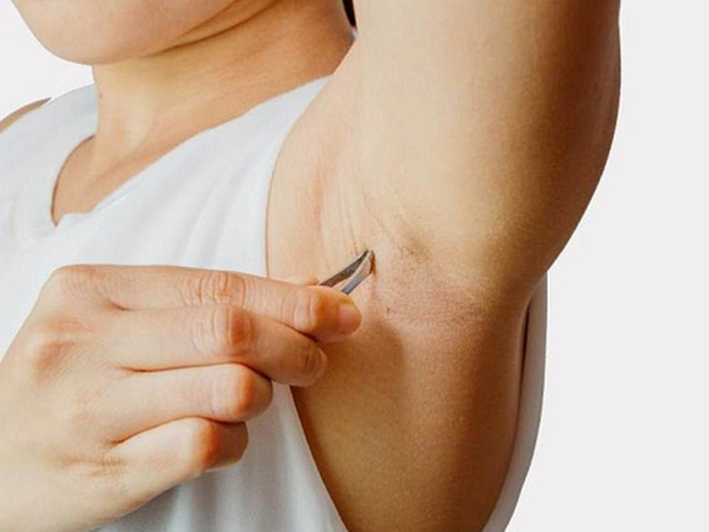 3 vị trí để lông phát triển, kẻo hại sức khỏe 3 vi tri de long phat trien, keo hai suc khoe