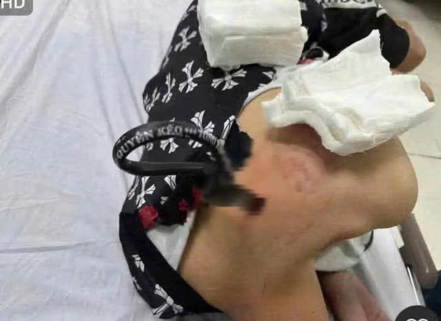 Nguoi dan ong dung keo tan cong nhieu nguoi di duong tai Can Tho