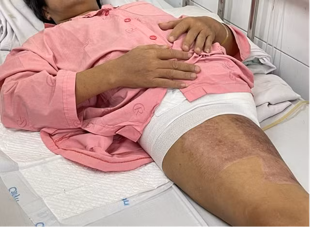 Hon 100 ngay gianh su song cho nguoi bi xe container can