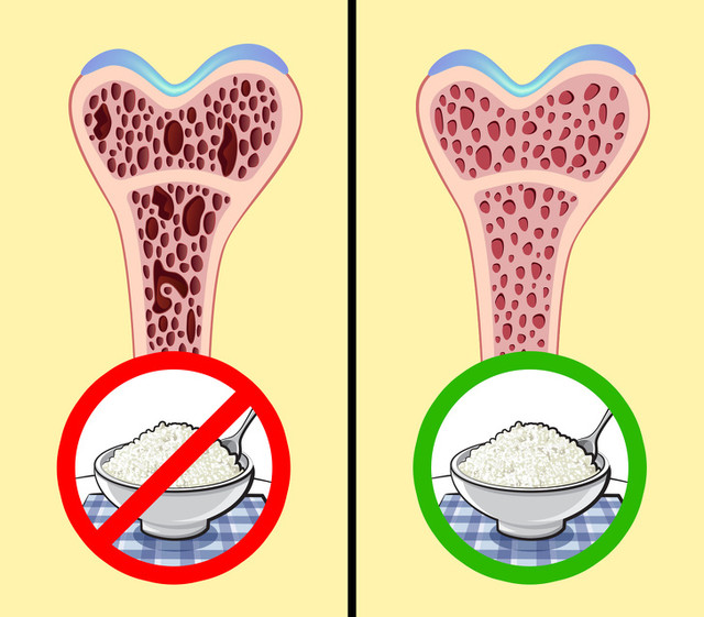 Ăn phô mai mỗi ngày, nhận về hàng tá điều kỳ diệu - Hình 5 An pho mai moi ngay, nhan ve hang ta dieu ky dieu-Hinh-5