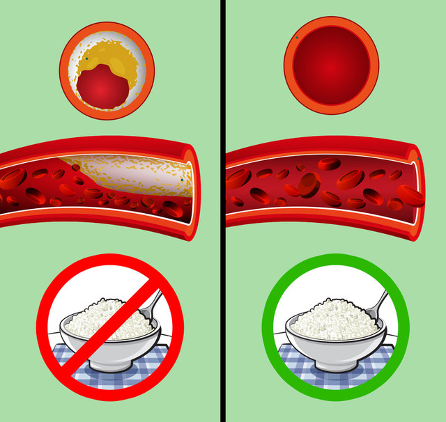 Ăn phô mai mỗi ngày, nhận về hàng tá điều kỳ diệu - Hình 7 An pho mai moi ngay, nhan ve hang ta dieu ky dieu-Hinh-7