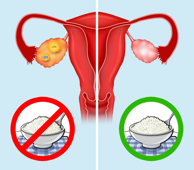 Ăn phô mai mỗi ngày, nhận về hàng tá điều kỳ diệu - Hình 4 An pho mai moi ngay, nhan ve hang ta dieu ky dieu-Hinh-4