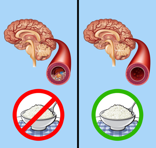 Ăn phô mai mỗi ngày, nhận về hàng tá điều kỳ diệu - Hình 8 An pho mai moi ngay, nhan ve hang ta dieu ky dieu-Hinh-8