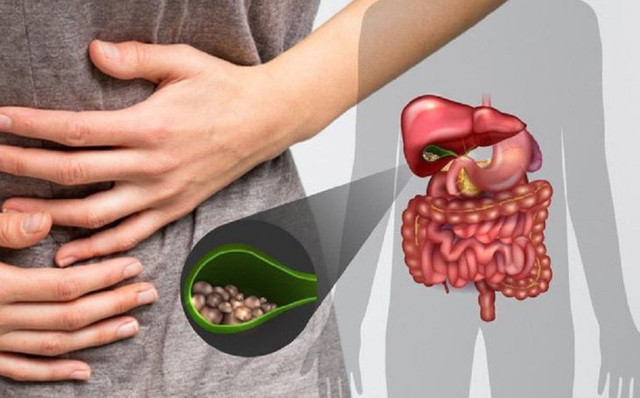 Bác sĩ nêu 7 kiểu người cực dễ mắc sỏi mật Bac si neu 7 kieu nguoi cuc de mac soi mat