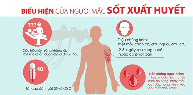 Dấu hiệu sốt xuất huyết cần cấp cứu kịp thời như nào? - Hình 2 Dau hieu sot xuat huyet can cap cuu kip thoi nhu nao?-Hinh-2