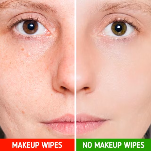 Nhung sai lam cham soc da khien mat ngay cang noi nhieu mun