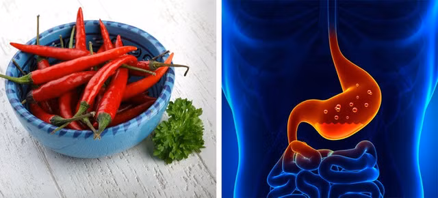 Nhung thuc pham khong nen an truoc khi ngu keo “thuc trang dem”-Hinh-6