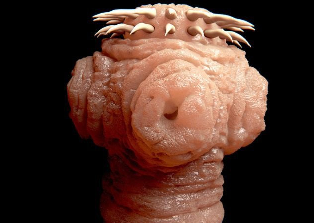 Những cách chăm sóc sắc đẹp kinh dị và nguy hiểm nổi tiếng thế giới - Hình 4 Nhung cach cham soc sac dep kinh di va nguy hiem noi tieng the gioi-Hinh-4