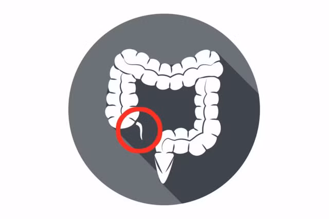 Ban van co the song binh thuong neu thieu toi 9 noi tang nay-Hinh-9