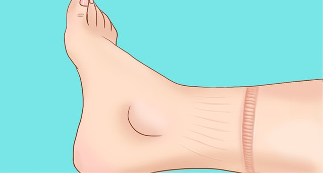 Cảnh báo dấu hiệu ngáp quá nhiều khi tập thể dục - Hình 3 Canh bao dau hieu ngap qua nhieu khi tap the duc-Hinh-3