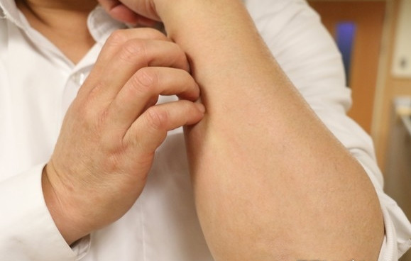 Da khô ngứa, đường huyết tăng nên bỏ ngay 2 món bữa sáng này Da kho ngua, duong huyet tang nen bo ngay 2 mon bua sang nay