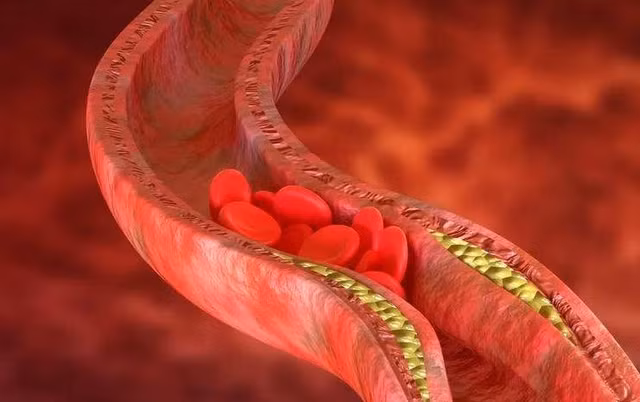 5 trieu chung xuat hien o tay chan co the ton tai cuc mau dong