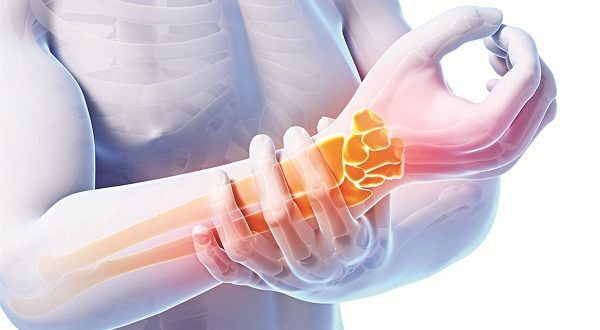 Đi bác sĩ ngay nếu xuất hiện 3 loại đau này - Hình 10 Di bac si ngay neu xuat hien 3 loai dau nay-Hinh-10