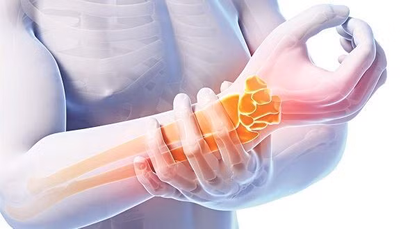 Đi bác sĩ ngay nếu xuất hiện 3 loại đau này - Hình 10 Di bac si ngay neu xuat hien 3 loai dau nay-Hinh-10