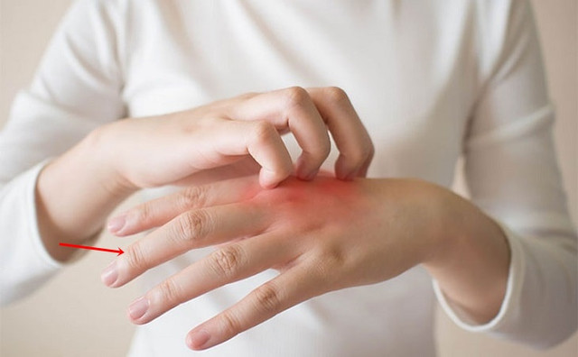Kiểm tra sức khoẻ của gan qua ngón tay giữa như nào? - Hình 5 Kiem tra suc khoe cua gan qua ngon tay giua nhu nao?-Hinh-5