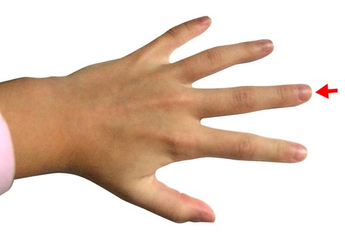 Kiểm tra sức khoẻ của gan qua ngón tay giữa như nào? - Hình 10 Kiem tra suc khoe cua gan qua ngon tay giua nhu nao?-Hinh-10