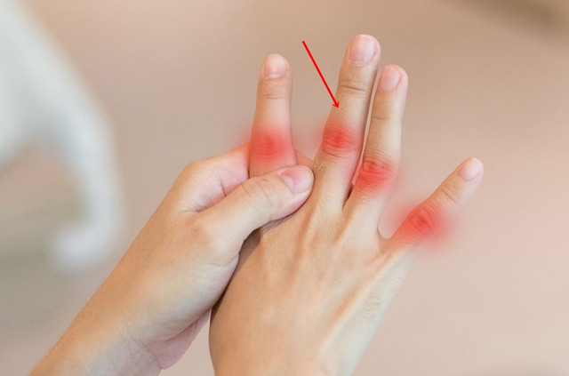 Kiểm tra sức khoẻ của gan qua ngón tay giữa như nào? - Hình 3 Kiem tra suc khoe cua gan qua ngon tay giua nhu nao?-Hinh-3