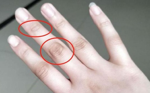 Kiểm tra sức khoẻ của gan qua ngón tay giữa như nào? - Hình 9 Kiem tra suc khoe cua gan qua ngon tay giua nhu nao?-Hinh-9