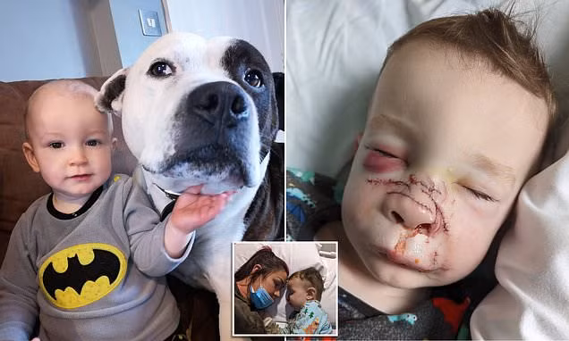 Nuoi cho cung, be trai 2 tuoi bi tan cong dau don