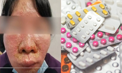 Kết hợp 7 loại thuốc để uống, người phụ nữ nguy kịch Ket hop 7 loai thuoc de uong, nguoi phu nu nguy kich