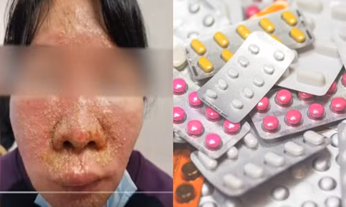 Ket hop 7 loai thuoc de uong, nguoi phu nu nguy kich